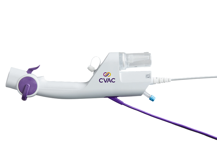 A picture of the handpiece for the CVAC System kidney stone treatment